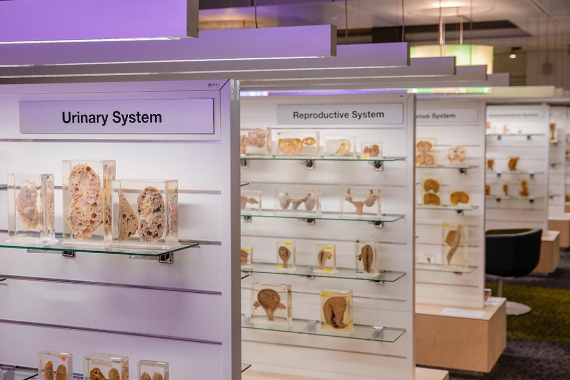 Interior view of a museum with modern glass displays housing pathological specimens.