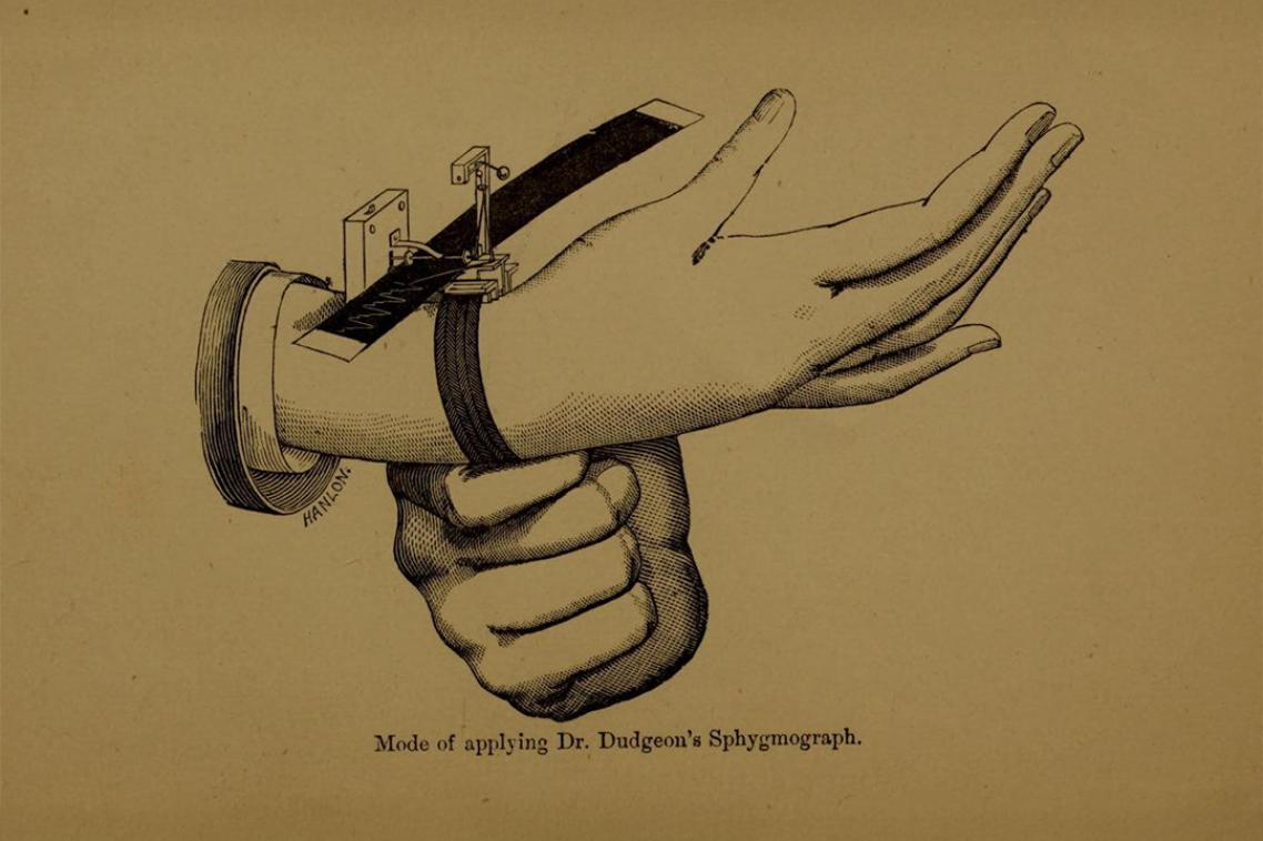 A sphygmograph from the museum of medical history